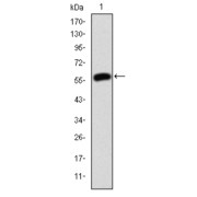 Western blot analysis using JUP antibody against human JUP (AA: 534-740) recombinant protein. (Expected MW is 48.5 kDa).