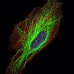 Tubulin Alpha-8 Chain (TUBA8) Antibody