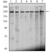 Western blot analysis using CHD3 antibody against Hela (1), K562 (2), Jurkat (3), NTERA-2 (4), HEK293 (5), Raji (6) cell lysate and mouse brain (7) tissue lysate.