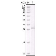 Western blot analysis using ERBB2 antibody against truncated ERBB2 recombinant protein.