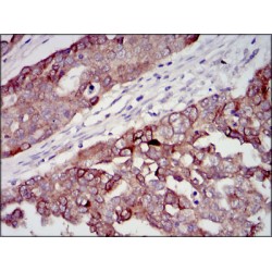 Insulin-Like Growth Factor II (IGF2) Antibody