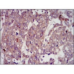 Insulin-Like Growth Factor II (IGF2) Antibody