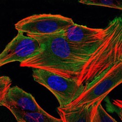 Ribosomal Protein S6 Kinase Alpha-3 (RPS6KA3) Antibody