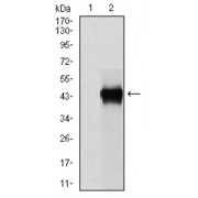 Western blot analysis using SERPINE1 antibody against human SERPINE1 (AA: 194-316) recombinant protein. (Expected MW is 45kDa kDa).