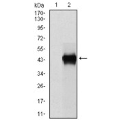 abx012034