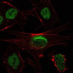 NAD-Dependent Protein Deacetylase Sirtuin-1 (SIRT1) Antibody