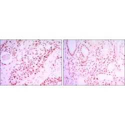 NAD-Dependent Protein Deacetylase Sirtuin-1 (SIRT1) Antibody