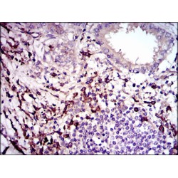 Transforming Growth Factor Beta 1 (TGFb1) Antibody
