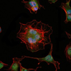 LIM/Homeobox Protein Lhx2 (LHX2) Antibody