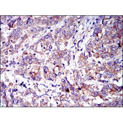 T-Cell Differentiation Antigen CD6 (CD6) Antibody