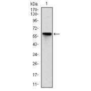 Western blot analysis using ROCK1 antibody against human ROCK1 (AA: 403-610) recombinant protein. (Expected MW is 158 kDa).