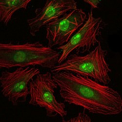 Cyclic AMP-Responsive Element-Binding Protein 1 (CREB1) Antibody