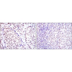 Cyclic AMP-Responsive Element-Binding Protein 1 (CREB1) Antibody