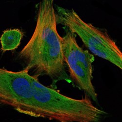 Protein Delta Homolog 1 (DLK1) Antibody