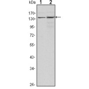 Western blot analysis using KDM3A antibody against Hela (1) and HepG2 (2) cell lysate.