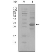 Western blot analysis using ALCAM antibody against truncated Trx-ALCAM recombinant protein (1).