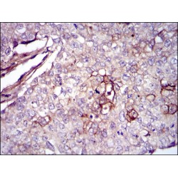Fibronectin (FN1) Antibody