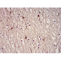 Glial Fibrillary Acidic Protein (GFAP) Antibody