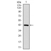 Western blot analysis using COTL1 antibody against human COTL1 (AA: 1-142) recombinant protein. (Expected MW is 16 kDa).