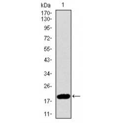 Cyclin-Dependent Kinase Inhibitor 2A (CDKN2A) Antibody