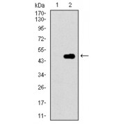Western blot analysis using CDKN2A antibody against human CDKN2A recombinant protein. (Expected MW is 19 kDa).