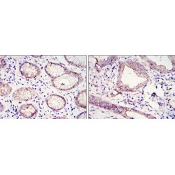 Cadherin-1 (CDH1) Antibody