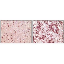 ELK1, Member Of ETS Oncogene Family (ELK1) Antibody