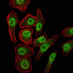 Lysine-Specific Demethylase 4A (KDM4A) Antibody