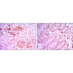 Lysine-Specific Demethylase 4A (KDM4A) Antibody