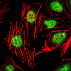 Zinc Finger And BTB Domain Containing 16 (ZBTB16) Antibody