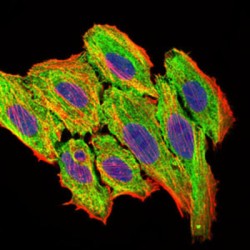 C-C Motif Chemokine 2 / MCP1 (CCL2) Antibody