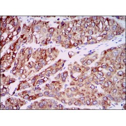 C-C Motif Chemokine 2 / MCP1 (CCL2) Antibody