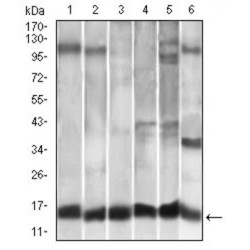 C-C Motif Chemokine 2 / MCP1 (CCL2) Antibody