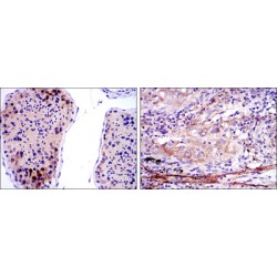 Survival of Motor Neuron 1, Telomeric (SMN1) Antibody