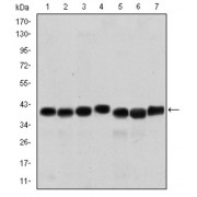 Western blot analysis using SMN1 antibody against HepG2 (1), Hela (2), K562 (3), Jurkat (4), SKBR-3 (5), A431 (6) and Cos7 (7) cell lysate.