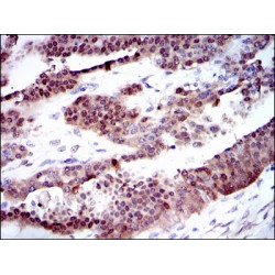 Cytochrome P450 1A1 (CYP1A1) Antibody