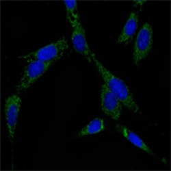 Heat Shock Protein 70 (HSP70) Antibody