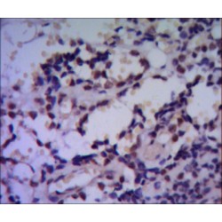 Heat Shock Protein 70 (HSP70) Antibody