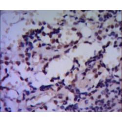 Heat Shock Protein 70 (HSP70) Antibody