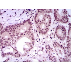 Myocyte-Specific Enhancer Factor 2C (MEF2C) Antibody