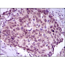 Myocyte-Specific Enhancer Factor 2C (MEF2C) Antibody