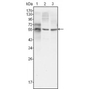Western blot analysis using TUBB3 antibody against HepG2 (1), A549 (2) and Hela (3) cell lysate.