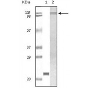 Western blot analysis using TYK2 antibody against truncated TYK2 recombinant protein (1) and Jurkat cell lysate (2).