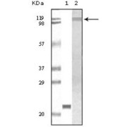 Western blot analysis using TYK2 antibody against truncated TYK2 recombinant protein (1) and Jurkat cell lysate (2).