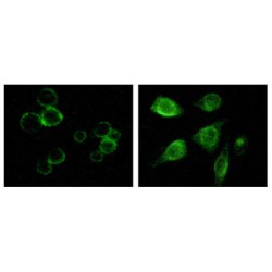 Tyrosine-Protein Kinase Receptor TYRO3 (TYRO3) Antibody