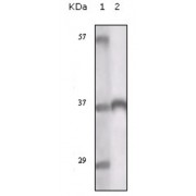 Western blot analysis using TYRO3 antibody against truncated TYRO3 recombinant protein.