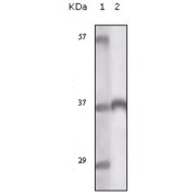 Western blot analysis using TYRO3 antibody against truncated TYRO3 recombinant protein.