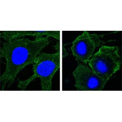 Kinase Insert Domain Receptor (KDR) Antibody