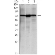 Western blot analysis using HSPA5 antibody against NIH/3T3 (1), Hela (2) and Jurkat (3) cell lysate.