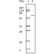 Western blot analysis using BSA antibody antiobdy against BSA.